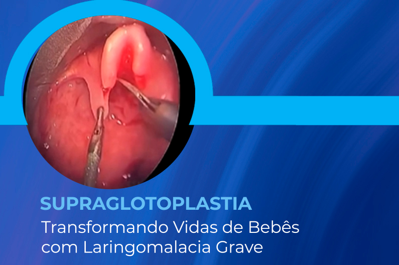 supraglotoplastia